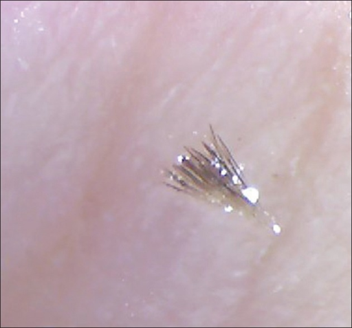 File:Trichostasis spinulosa 3.png